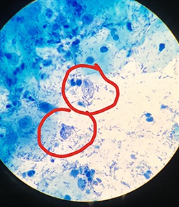 Хламидии в клетке под микроскопом
