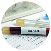 Простато-специфический антиген общий PSA тест